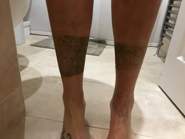 legs mud