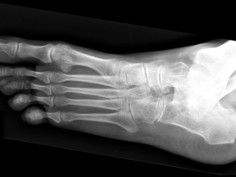 Old Dude Diaries #1: the 101