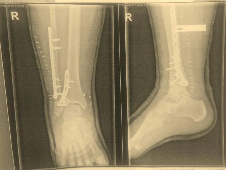 My Summer Was Over Before It Even Started