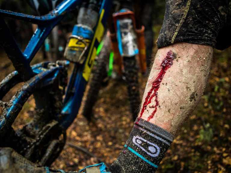 Martin Maes Faces 90 Day Doping Ban – From A Race Doctor’s Prescription