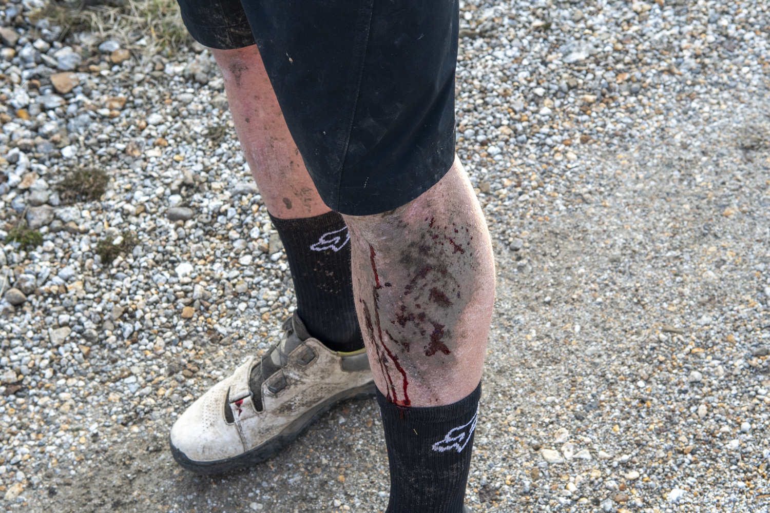 nidderdale loop scar house mtb route